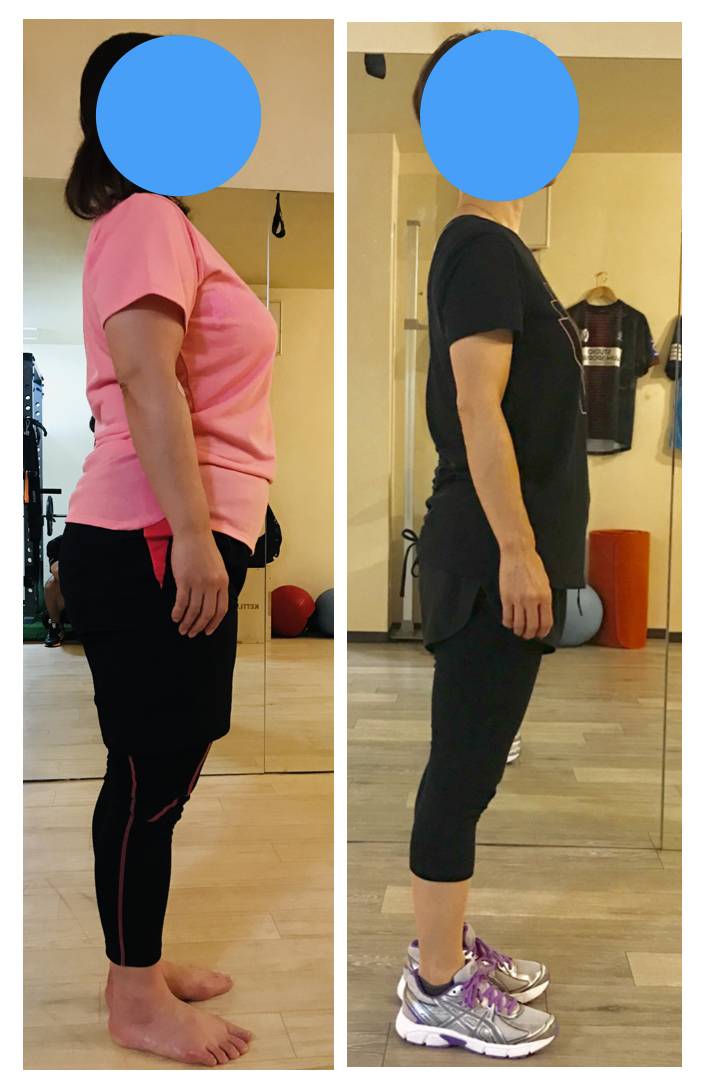 【小田原市】猫背を本気で改善したい方へ｜パーソナルトレーニングという選択